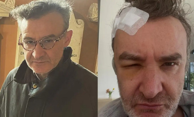 Συγκλονίζει ο Νίκος Ορφανός: «Ο όγκος στο κεφάλι εντοπίστηκε 20 μέρες μετά τη γέννηση του παιδιού μου»