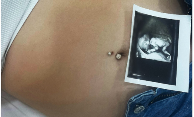 Baby boom: Κύπρια influencer ανακοίνωσε την πρώτη της εγκυμοσύνη (ΦΩΤΟ)