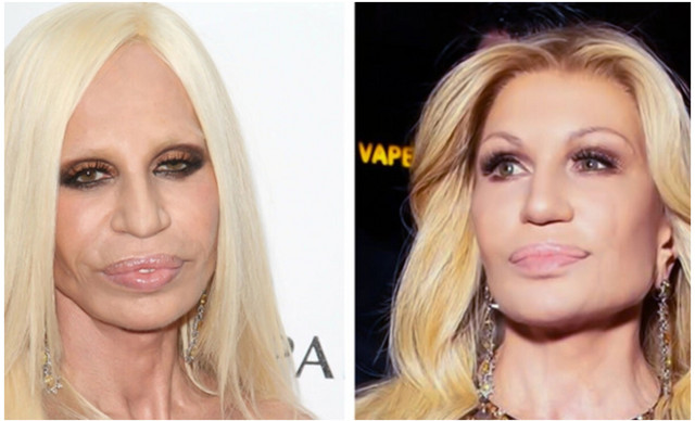 Αγνώριστη η Donatella Versace: Τι σχολιάζουν οι ειδικοί για τις αλλαγές στο πρόσωπό της
