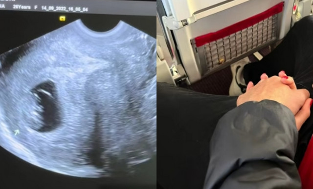 Baby Boom! Έγκυος για πρώτη φορά δημοφιλής Ελληνίδα influencer (BINTEO)