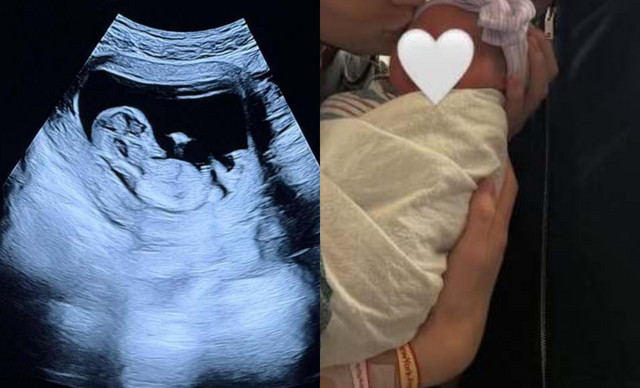 &Pi;&alpha;&sigma;ί&gamma;&nu;&omega;&sigma;&tau;&omicron; &Chi;&omicron;&lambda;&iota;&gamma;&omicron;&upsilon;&nu;&tau;&iota;&alpha;&nu;ό &zeta;&epsilon;&upsilon;&gamma;ά&rho;&iota; &upsilon;&pi;&omicron;&delta;έ&chi;&tau;&eta;&kappa;&alpha;&nu; &tau;&omicron; &pi;&rho;ώ&tau;&omicron; &tau;&omicron;&upsilon;&sigmaf; &pi;&alpha;&iota;&delta;ί