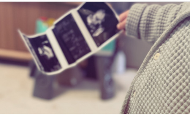 &Pi;&alpha;&sigma;ί&gamma;&nu;&omega;&sigma;&tau;&omicron;&sigmaf; Έ&lambda;&lambda;&eta;&nu;&alpha;&sigmaf; &eta;&theta;&omicron;&pi;&omicron;&iota;ό&sigmaf; &alpha;&nu;&alpha;&kappa;&omicron;ί&nu;&omega;&sigma;&epsilon; &sigma;&tau;&omicron;&nu; &laquo;&alpha;έ&rho;&alpha;&raquo; ό&tau;&iota; &pi;&epsilon;&rho;&iota;&mu;έ&nu;&epsilon;&iota; &tau;&omicron; &delta;&epsilon;ύ&tau;&epsilon;&rho;&omicron; &pi;&alpha;&iota;&delta;ί &tau;&omicron;&upsilon;