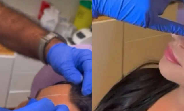 Aυτή είναι η πασίγνωστη τραγουδίστρια που κάνει botox και βάζει fillers μπροστά στην κάμερα (ΒΙΝΤΕΟ)