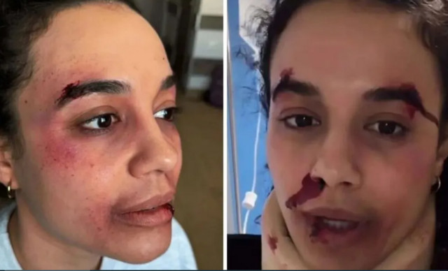 &Pi;&eta;&nu;&epsilon;&lambda;ό&pi;&eta; &Pi;&lambda;ά&kappa;&alpha;: &Omicron;&iota; &phi;&omega;&tau;&omicron;&gamma;&rho;&alpha;&phi;ί&epsilon;&sigmaf; &mu;&epsilon; &alpha;&mu;&upsilon;&chi;έ&sigmaf; &kappa;&alpha;&iota; &mu;ώ&lambda;&omega;&pi;&epsilon;&sigmaf; &ndash; &ldquo;&Pi;ή&rho;&alpha; &tau;&eta; &mu;&alpha;&mu;ά &mu;&omicron;&upsilon; &tau;&eta;&lambda;έ&phi;&omega;&nu;&omicron;&rdquo; (&Epsilon;&iota;&kappa;ό&nu;&epsilon;&sigmaf;)