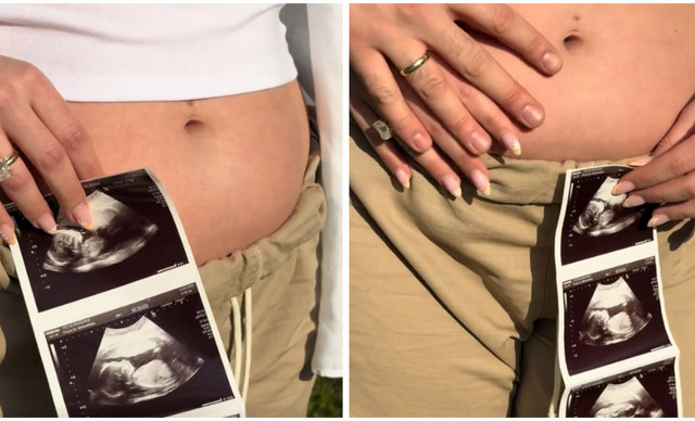 &Gamma;&nu;&omega;&sigma;&tau;ή &Kappa;ύ&pi;&rho;&iota;&alpha; TikToker &pi;&epsilon;&rho;&iota;&mu;έ&nu;&epsilon;&iota; &tau;&omicron; &pi;&rho;ώ&tau;&omicron; &tau;&eta;&sigmaf; &pi;&alpha;&iota;&delta;ί &ndash; &Eta; &tau;&rho;&upsilon;&phi;&epsilon;&rho;ή &alpha;&nu;&alpha;&kappa;&omicron;ί&nu;&omega;&sigma;&eta; (&Beta;&Iota;&Nu;&Tau;&Epsilon;&Omicron;)