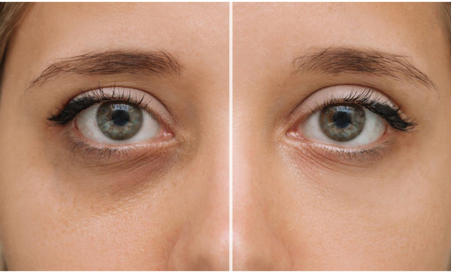 Beauty secrets: &Omicron;&iota; &epsilon;&iota;&delta;&iota;&kappa;&omicron;ί &alpha;&pi;&omicron;&kappa;&alpha;&lambda;ύ&pi;&tau;&omicron;&upsilon;&nu; &pi;ώ&sigmaf; &nu;&alpha; &mu;&epsilon;&iota;ώ&sigma;&epsilon;&iota;&sigmaf; &phi;&upsilon;&sigma;&iota;&kappa;ά &tau;&omicron;&upsilon;&sigmaf; &mu;&alpha;ύ&rho;&omicron;&upsilon;&sigmaf; &kappa;ύ&kappa;&lambda;&omicron;&upsilon;&sigmaf;