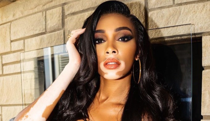 Η Winnie Harlow έκοψε τα μαλλιά της κοντά και είναι τέλεια – Δείτε το νέο look της