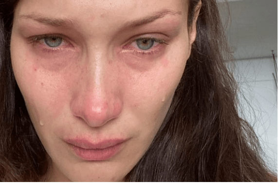 Η Bella Hadid με κλάματα: «Τα μέσα κοινωνικής δικτύωσης δεν είναι αληθινά»