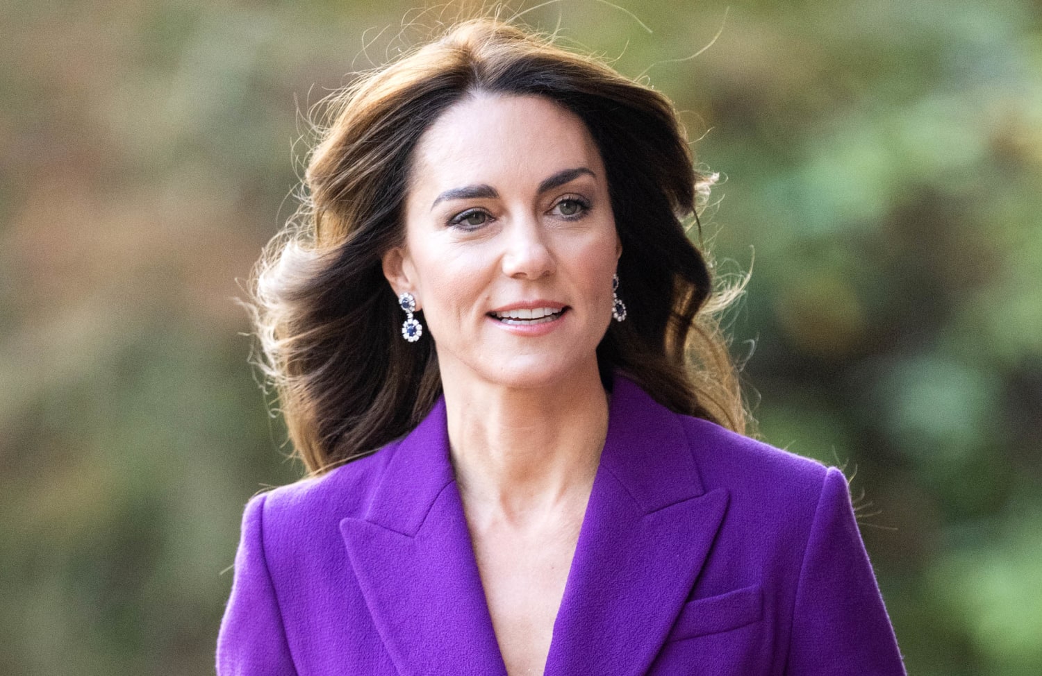 Αισιοδοξία για την Kate Middleton  - Ο οργανισμός της ανταποκρίνεται στη θεραπεία