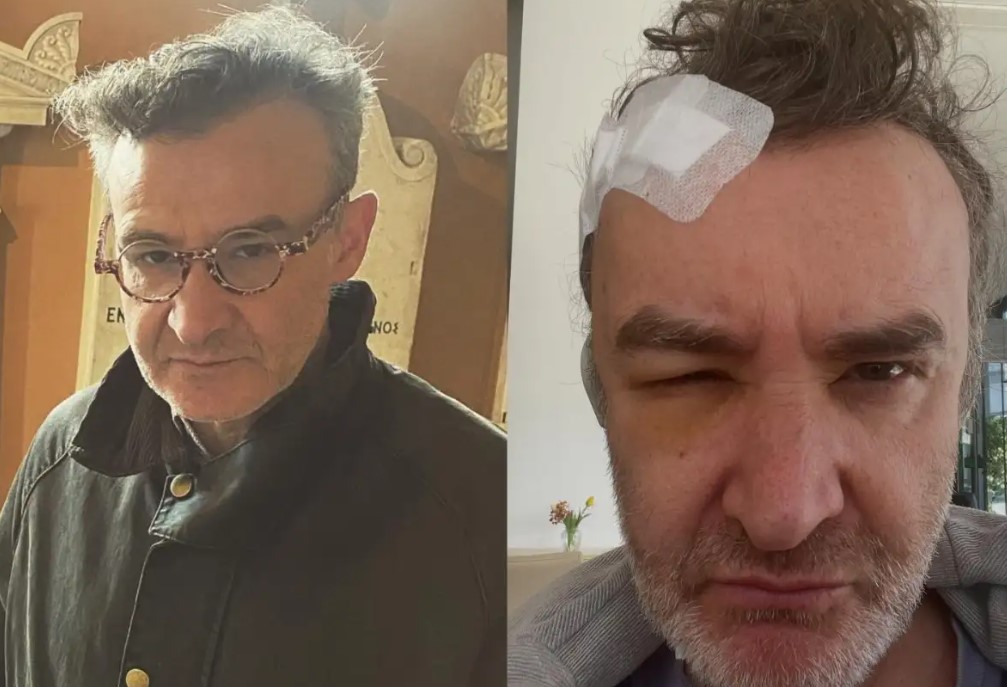 Συγκλονίζει ο Νίκος Ορφανός: «Ο όγκος στο κεφάλι εντοπίστηκε 20 μέρες μετά τη γέννηση του παιδιού μου»