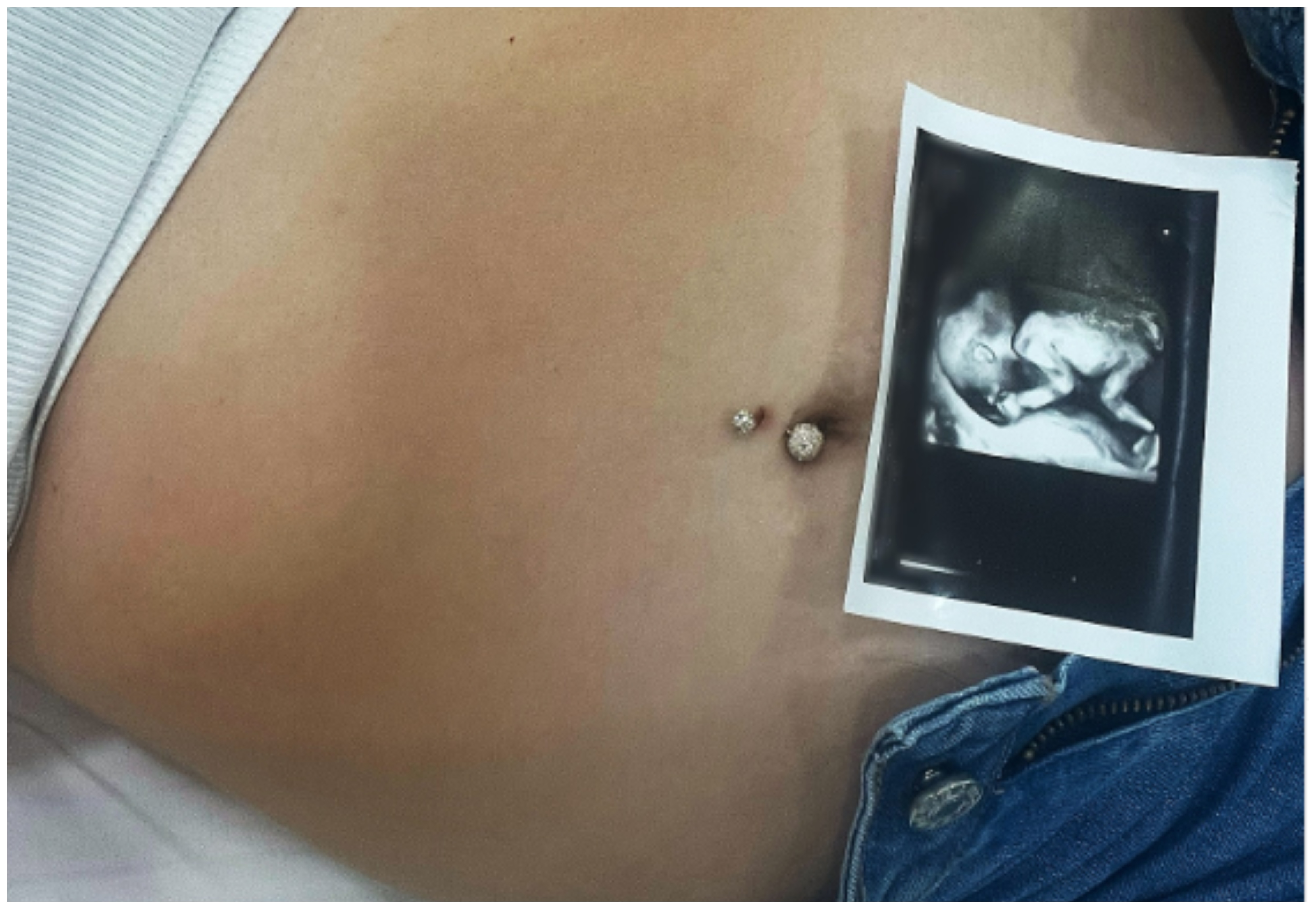 Baby boom: Κύπρια influencer ανακοίνωσε την πρώτη της εγκυμοσύνη (ΦΩΤΟ)
