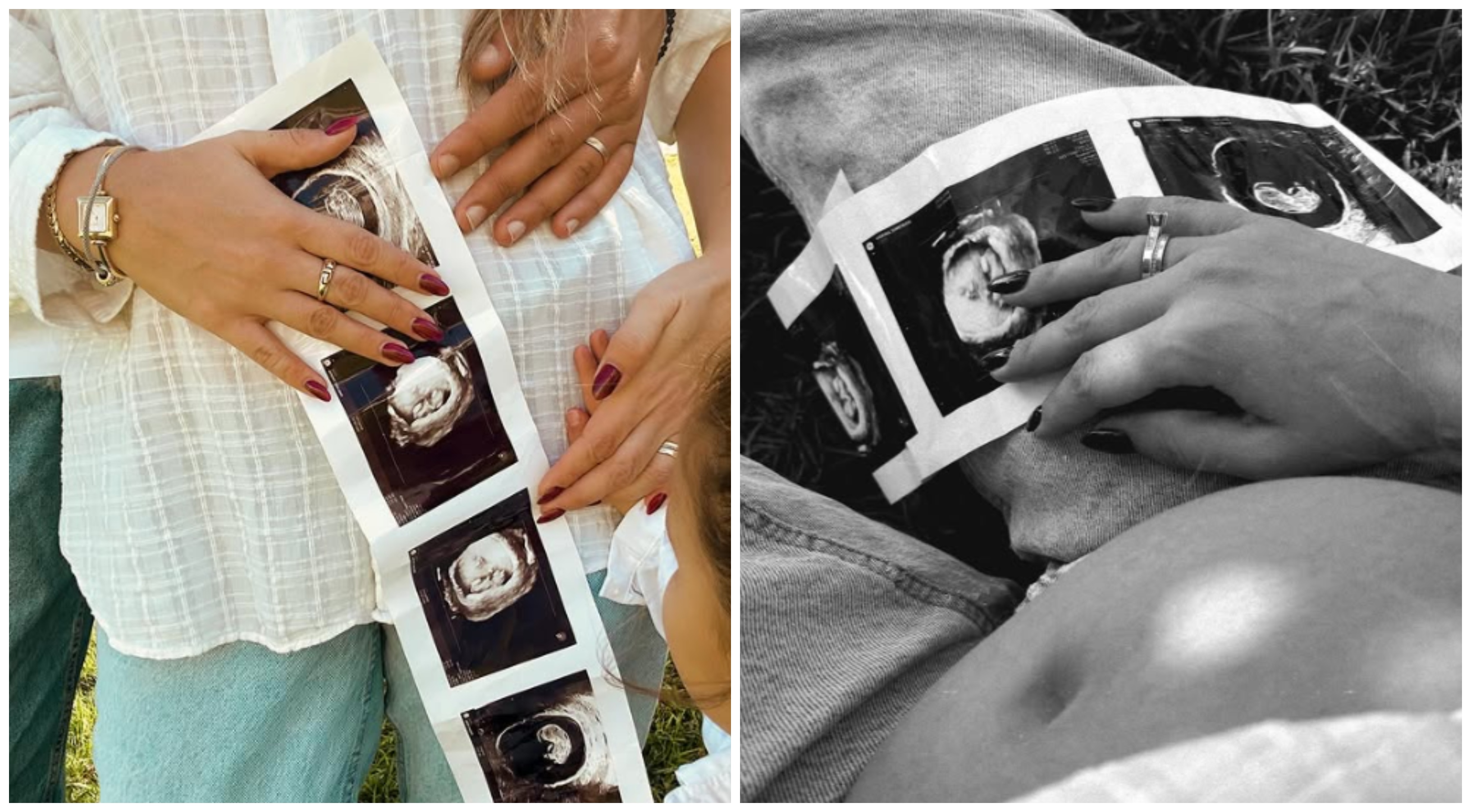 Baby Boom! Γνωστή Κύπρια ηθοποιός ανακοίνωσε τη δεύτερη εγκυμοσύνη της