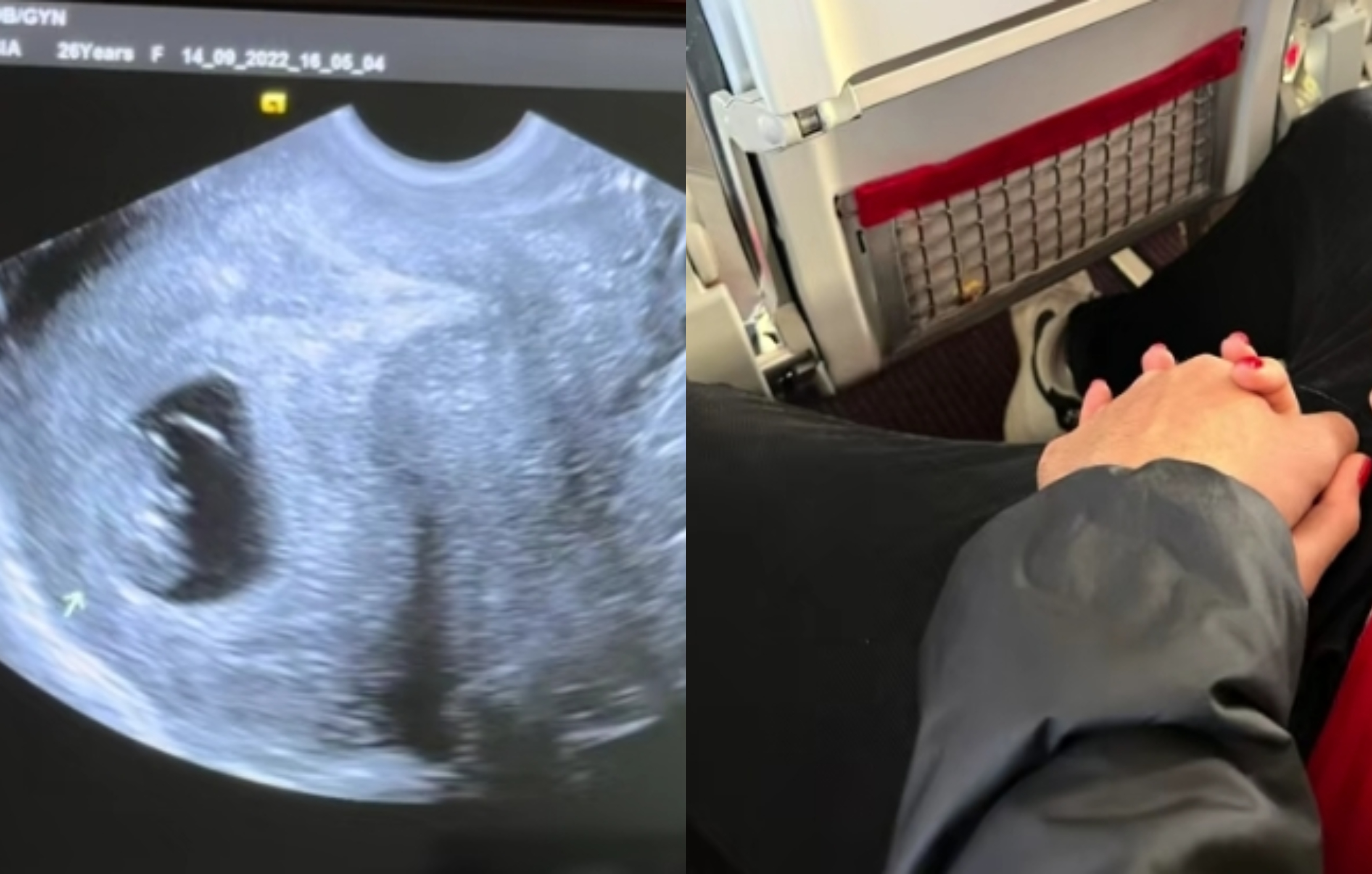 Baby Boom! Έγκυος για πρώτη φορά δημοφιλής Ελληνίδα influencer (BINTEO)