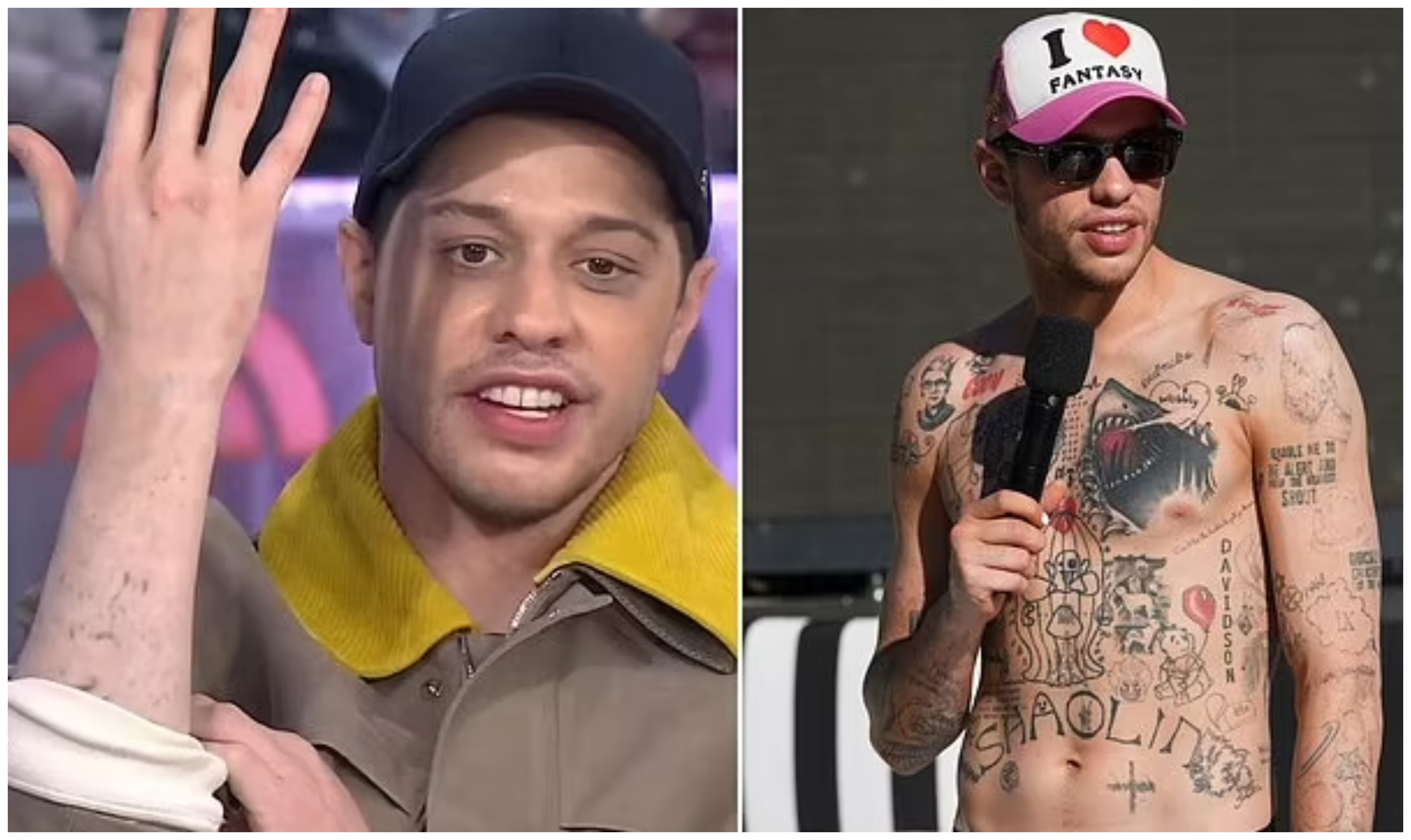 Πιτ Ντέιβιντσον: Το υπέρογκο ποσό που έχει ξοδέψει για αφαίρεση τατουάζ