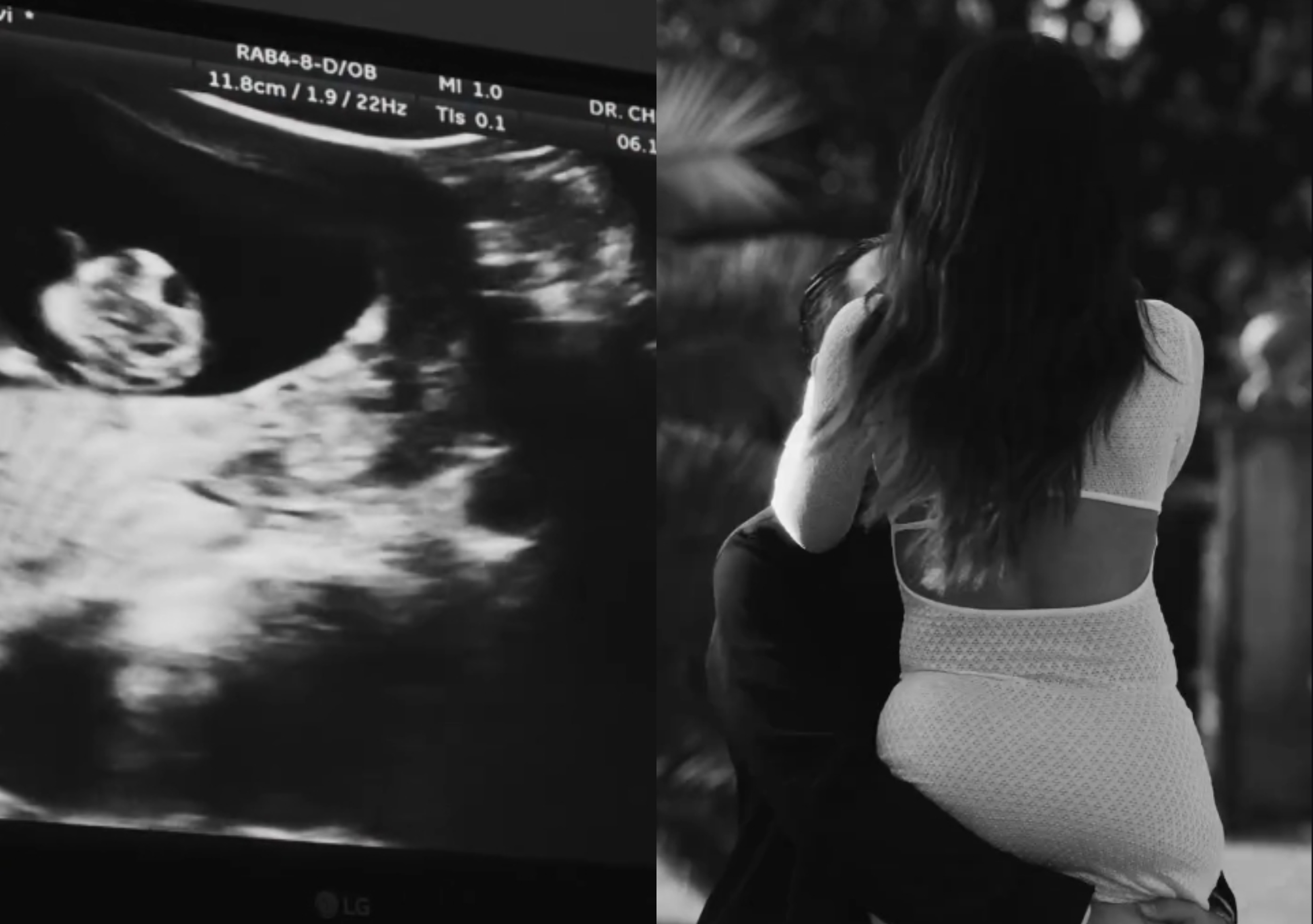 Baby boom! για πασίγνωστη Ελληνίδα influencer – Είναι έγκυος στο πρώτο της παιδί (ΒΙΝΤΕΟ)