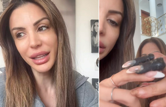 Συγκλονίζει η Λουκία Κυριάκου: “Θα ακρωτηριάσουν τα δάχτυλα της μητέρας μου” (ΒΙΝΤΕΟ)