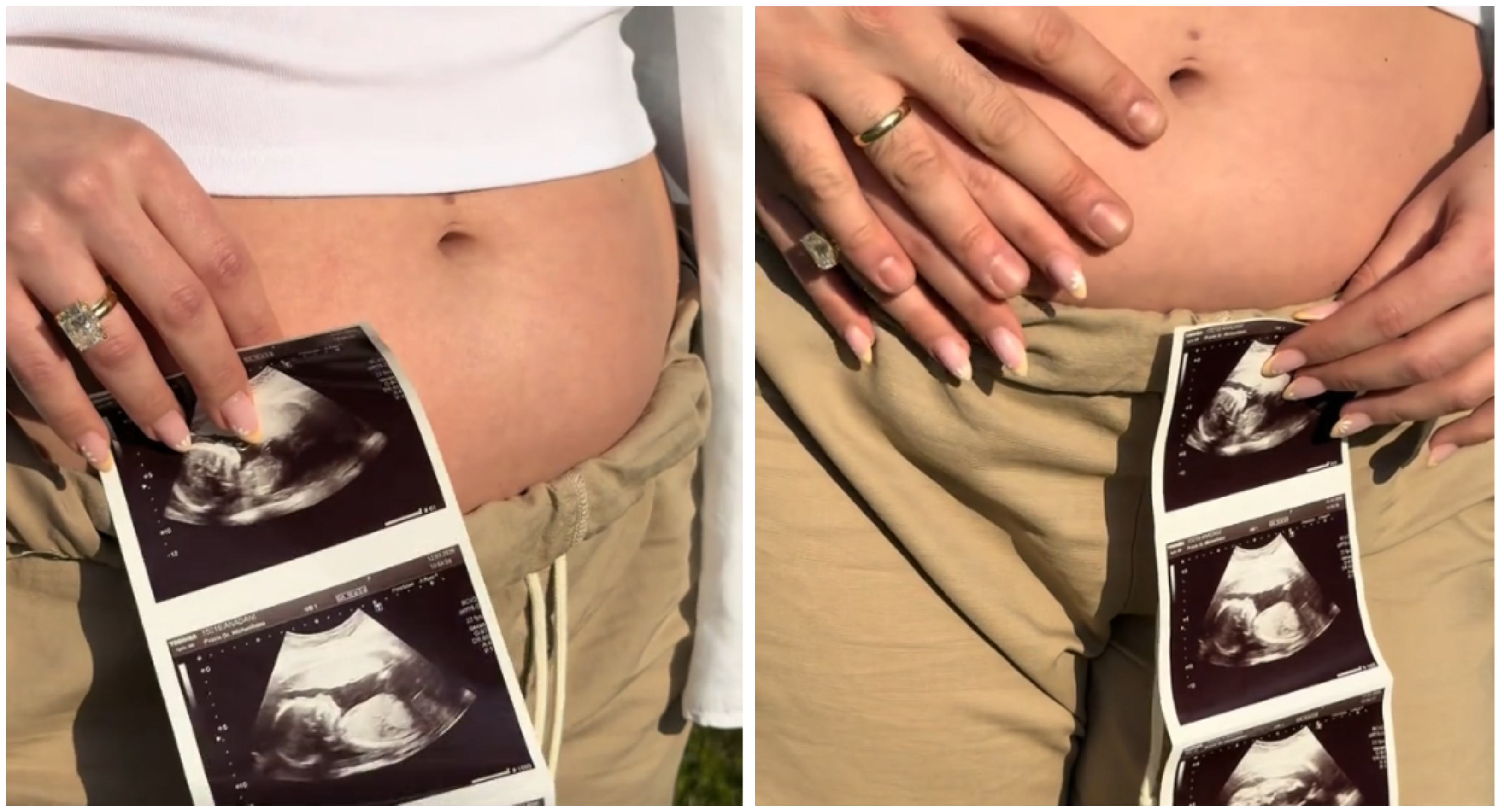 Γνωστή Κύπρια TikToker περιμένει το πρώτο της παιδί – Η τρυφερή ανακοίνωση (ΒΙΝΤΕΟ)