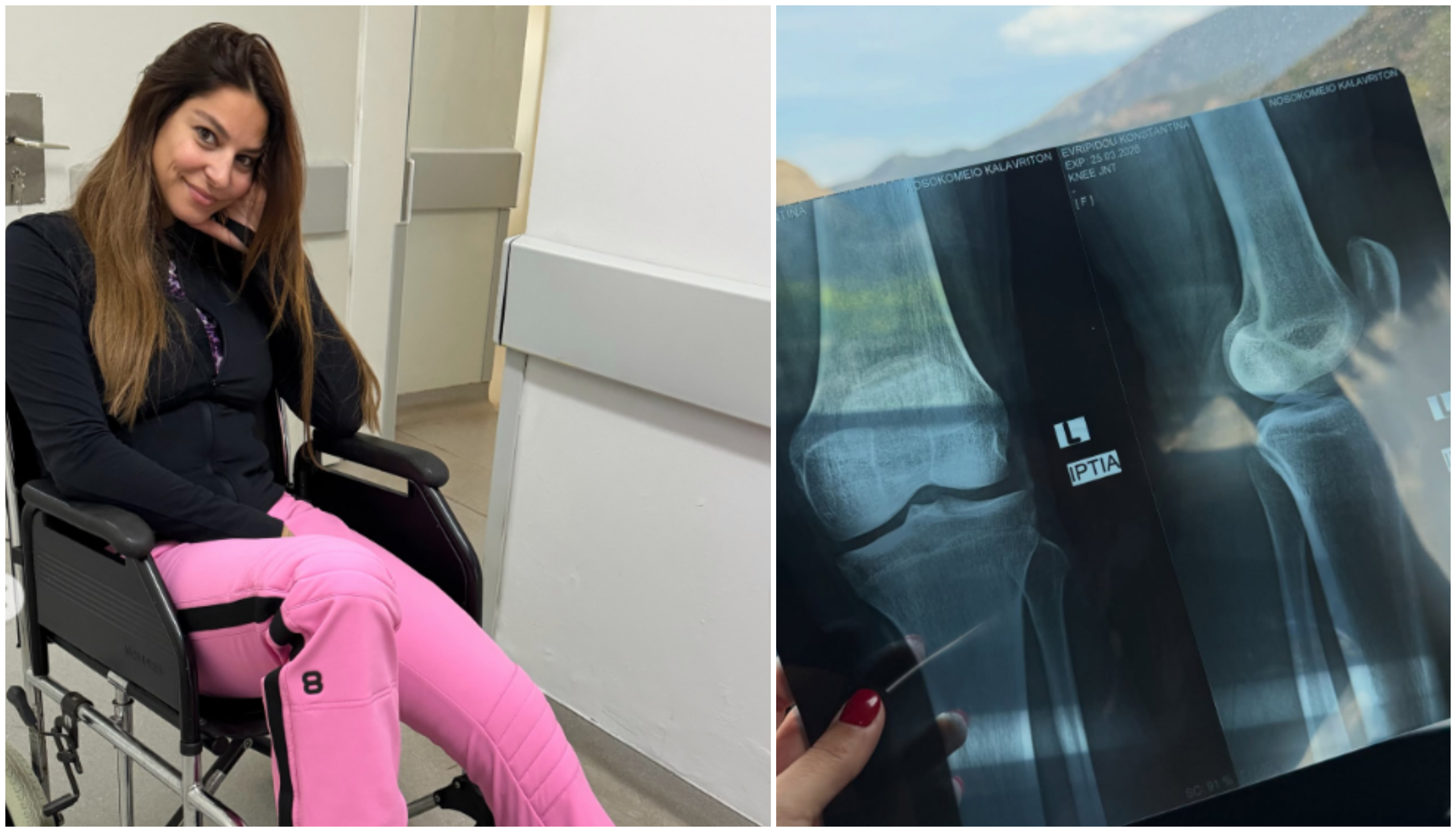 Κωνσταντίνα Ευριπίδου: Στο νοσοκομείο με νάρθηκα στο πόδι – Τι συνέβη;